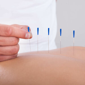 Acupuntura na psiquiatria